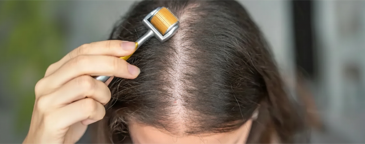 Hair Loss Myths vs Facts: What Really Works?